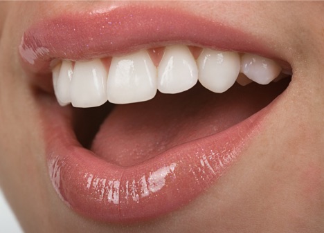 Image of women's smiling showing her clean white teeth